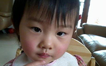 小孩子脸蛋总是红的是怎么回事 儿童脸红过敏怎么办
