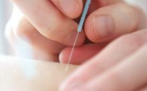 放血疗法的原理 放血疗法的副作用