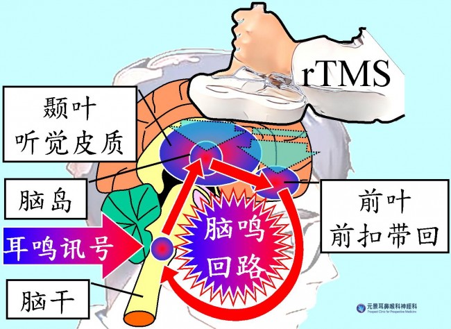耳鸣脑鸣困扰终结:台湾高雄元景耳鼻喉科神经科的成功案例分享