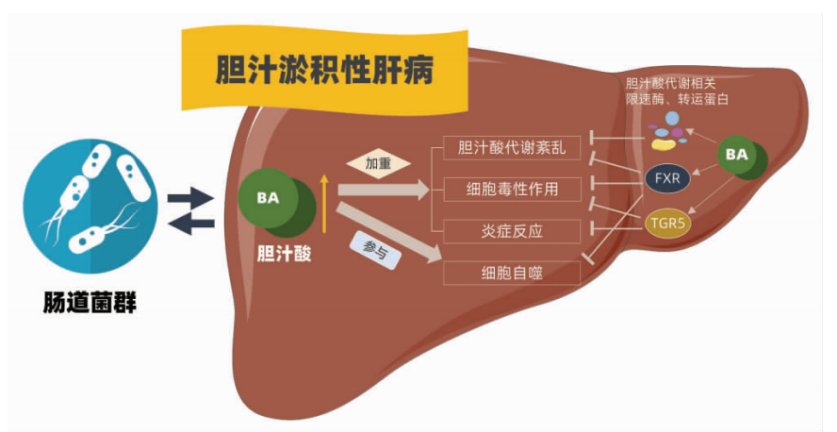 肠道菌群在非酒精性脂肪性肝病中的研究进展