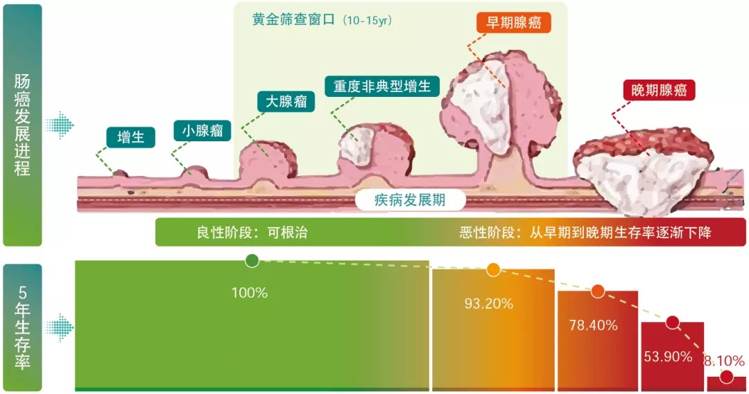 专家科普说 | 压力大、精神紧张会造成肠道不适,影响肠道健康